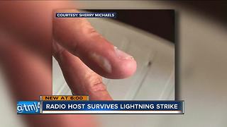 Wisconsin sportscaster Bill Michaels survives lightning strike