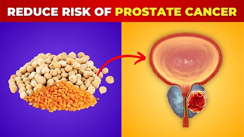 99% Less Risk: Foods Proven to Reduce Prostate Cancer Risk