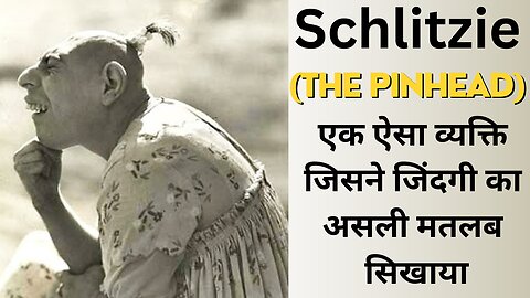 Sad Story of Schlitzie। एक ऐसा व्यक्ति जिसने जिंदगी का असली मतलब सिखाया इसके माँ बाप ने इसे बेच दिया