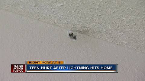 Teen develops mysterious rash after lightning strikes her Palm Harbor home