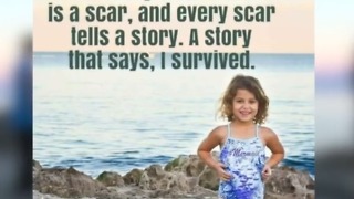Violet Jalil: 4 year old bitten by shark at bathtub beach returns to beach for first time