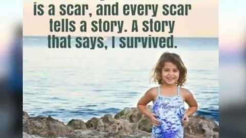 Violet Jalil: 4 year old bitten by shark at bathtub beach returns to beach for first time