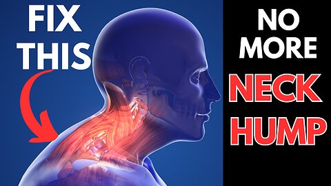 How to FIX the Hump on the Back of Your Neck