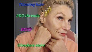 Alopecia Hair loss PDO threads Glowface.store DIY55