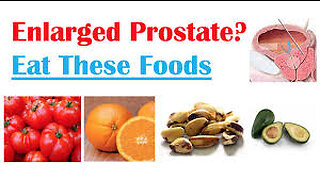 Best Foods to Eat With Enlarged Prostate Reduce Risk of Symptoms Enlarged & Cancer