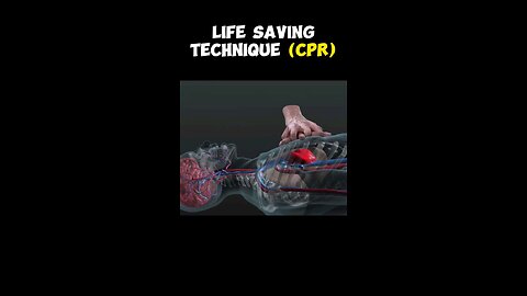 CPR Life Saving Procedure