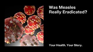Was Measles Really Eradicated?