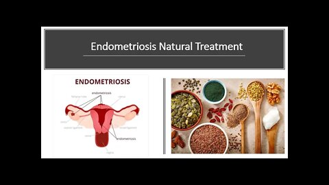 Endometriosis Natural Treatment Options