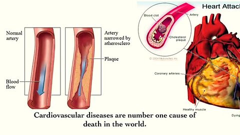 Say Goodbye to High Cholesterol with These Simple Tips