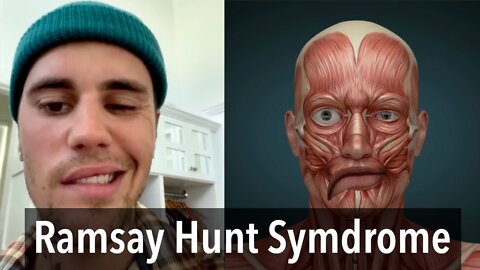 Justin Bieber Facial Paralysis - Ramsay Hunt Syndrome