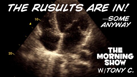 At Least There Is No Evidence of Aortic Valve Stenosis