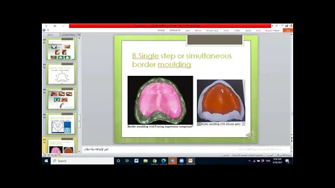 Prosthodontics L12 (impressions in complete denture)