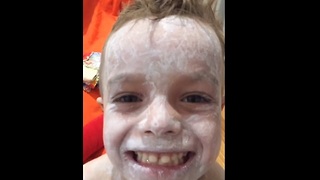 Boy Dances With Joy After Being Rid Of His Painful Eczema