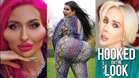 5 Plastic Surgeries That Stunned The World | HOOKED ON THE LOOK