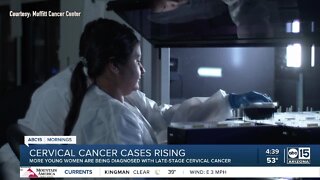 Cervical cancer cases rising among young women