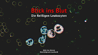 Blick ins Blut | Die fleißigen Leukozyten