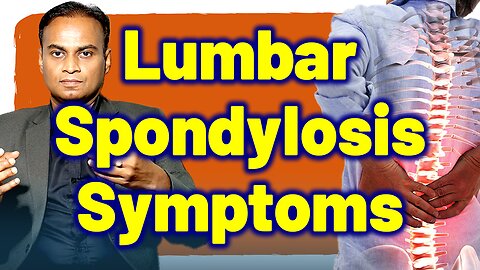 Signs and Symptoms of Lumbar Spondylosis - Homeopathy Treatment & Cure, Remedy | Dr. Bharadwaz