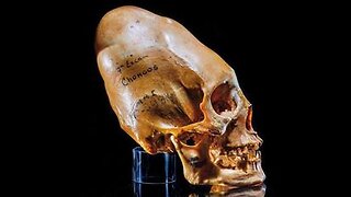 Forbidden Anthropology Elongated Skulls & Sasquatch! Loyd Pye & Brien Forester