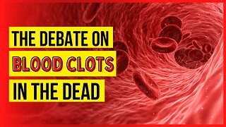 The Debate on Blood Clots from Covid-19 or the Vaccine Discussed By Embalmers