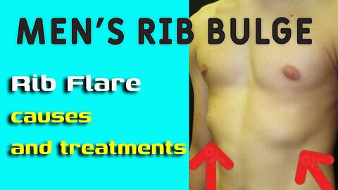 MEN'S RIB BULGE - Rib Flare causes & treatments (mini documentary 11)