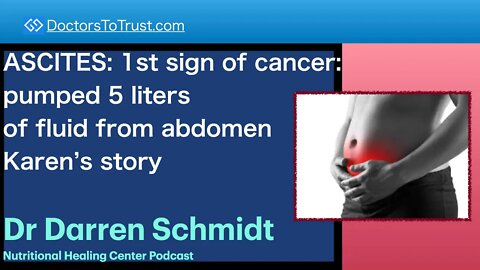 DARREN SCHMIDT 3 | ASCITES: 1st sign of cancer: pumped 5 liters of fluid from abdomen. Karen’s story