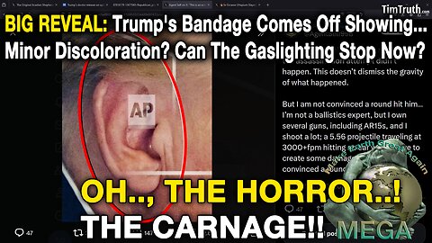 BIG REVEAL: Trump's Bandage Comes Off Showing... Minor Discoloration? Can The Gaslighting Stop Now?