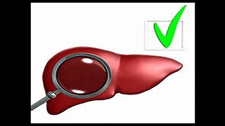 5. Hepatitis (Liver inflammation/disease)