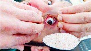 How Painful is Salt In Your Eye?