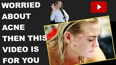 How to Get Rid of Acne