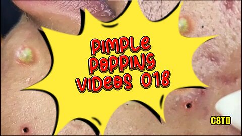 Satisfying Pimple Popping Videos 018