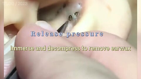 Relieve pressure to clean earwax