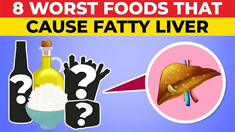 8 Worst Foods That Lead To Fatty Liver