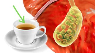 Chá Para Aliviar A Infecção Na Vesícula E Estimular A Produção Da Bile