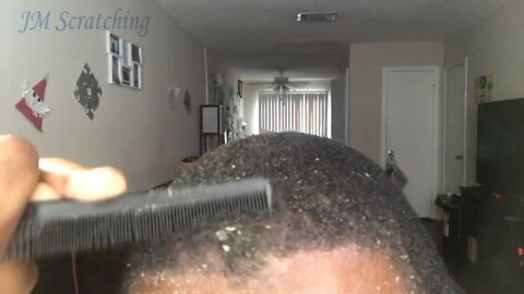 Getting Rid of Stubborn Dandruff