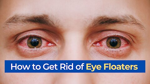 how to get rid of eye floaters