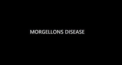 Enfermedad de Morgellons