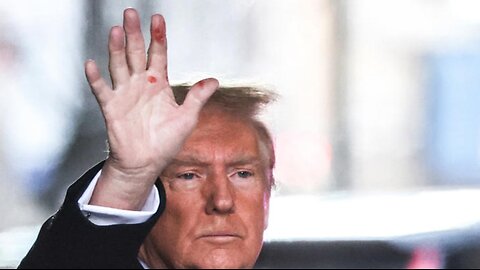 RED MARKS ON DONALD TRUMPS HAND WAS A SMALL PAPER CUT FOR THE BENEFIT OF ALL - King Street News