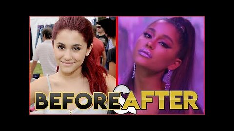 Ariana Grande | Before & After | Transformation ( Hair, Plastic Surgery, Make Up & More )