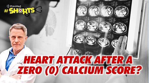 #SHORTS Heart Attack After a zero Calcium Score?