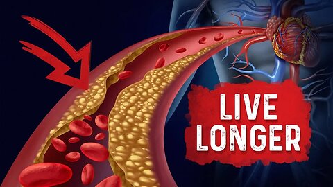 Bad Cholesterol Can Make You Live Longer - Dr. Berg