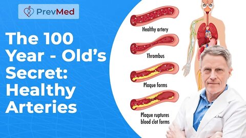 The 100 Year - Old’s Secret: Healthy Arteries