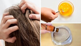 3 Home Remedies for Itchy Scalp Tried and Tested