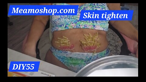Meamoshop.com skin tighten PDO threads DIY55 abdominal area