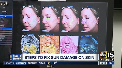 Sun damage and how to reverse its effects on your skin