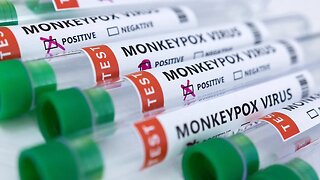 Monkeypox Is Now A 'Potential Global Emergency'