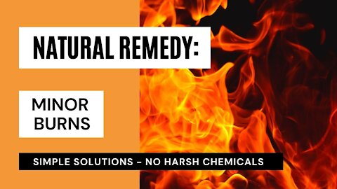Natural Remedy: Minor Burns - 4 ways to treat minor burns at home.