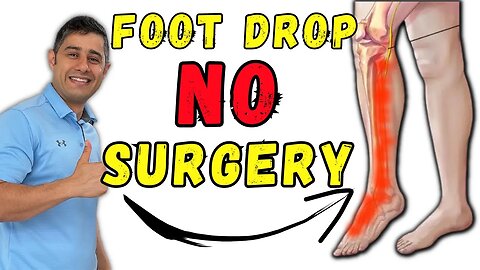 Foot Drop recovery without surgery