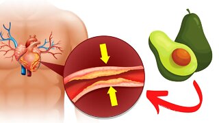 The 5 Best Fruits To Lower Bad Cholesterol