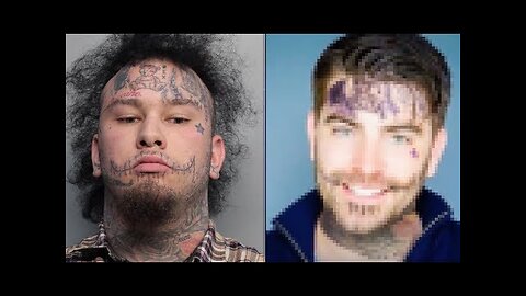 Rapper Stitches Face Tattoos on Michael McCrudden | Photoshop Tattoo Removal