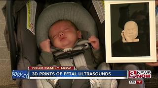 Clinic offers 3D prints of fetal ultrasounds